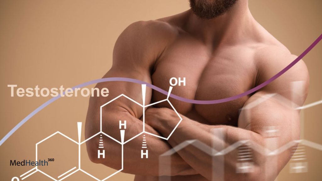 Testosterone Replacement Therapy