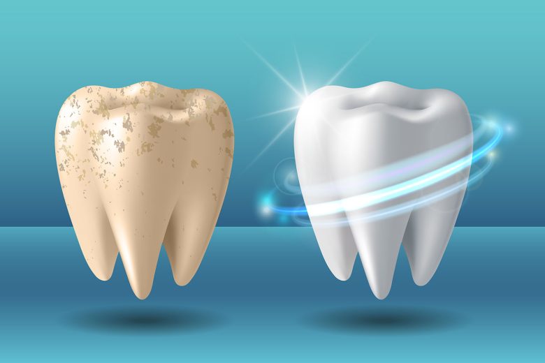 advanced dental care